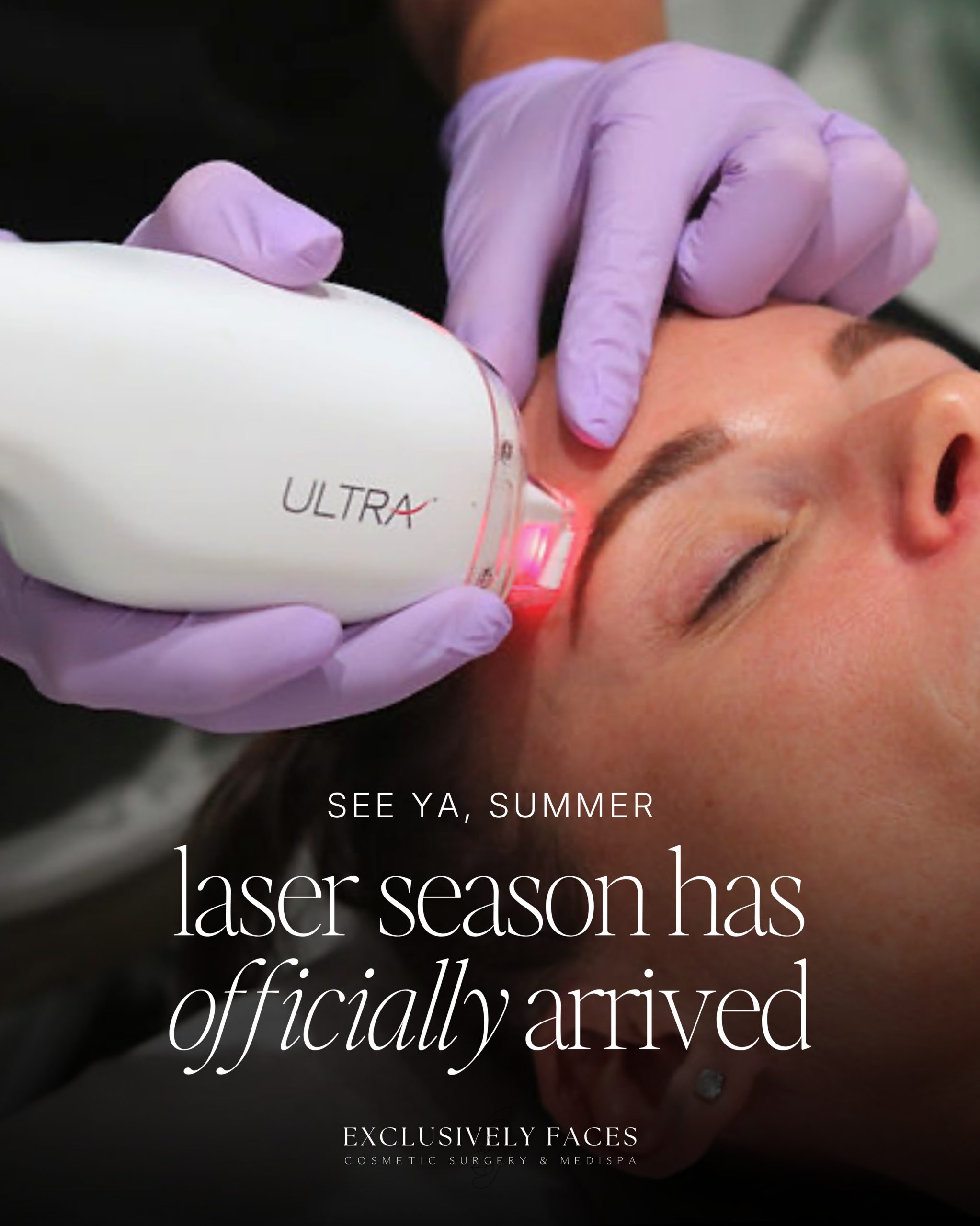 Laser season is BACKKKKK Summer may be winding down, but we’re just getting started. If pigmentation, fine lines, wrinkles, sun damage, acne scars or texture are on your list to tackle this fall, now is the time to start planning your treatments. Laser season gets busy and our schedules fill quickly—especially since typical treatment plans includes a series or multiple treatments spaced several weeks apart. Starting now gives you the time to complete your treatments and let your skin do the work. Not sure which treatment is right for you? That’s exactly what your complimentary consultation is for. We’ll assess your skin, talk through your goals, and create a treatment plan tailored to you. Ready for laser season? Call or visit our website to get on the schedule! 678-857-3211 www.exclusivelyfaces.com Sharpsburg, GA . . #laserresurfacing #lasertreatment #skin #skincare