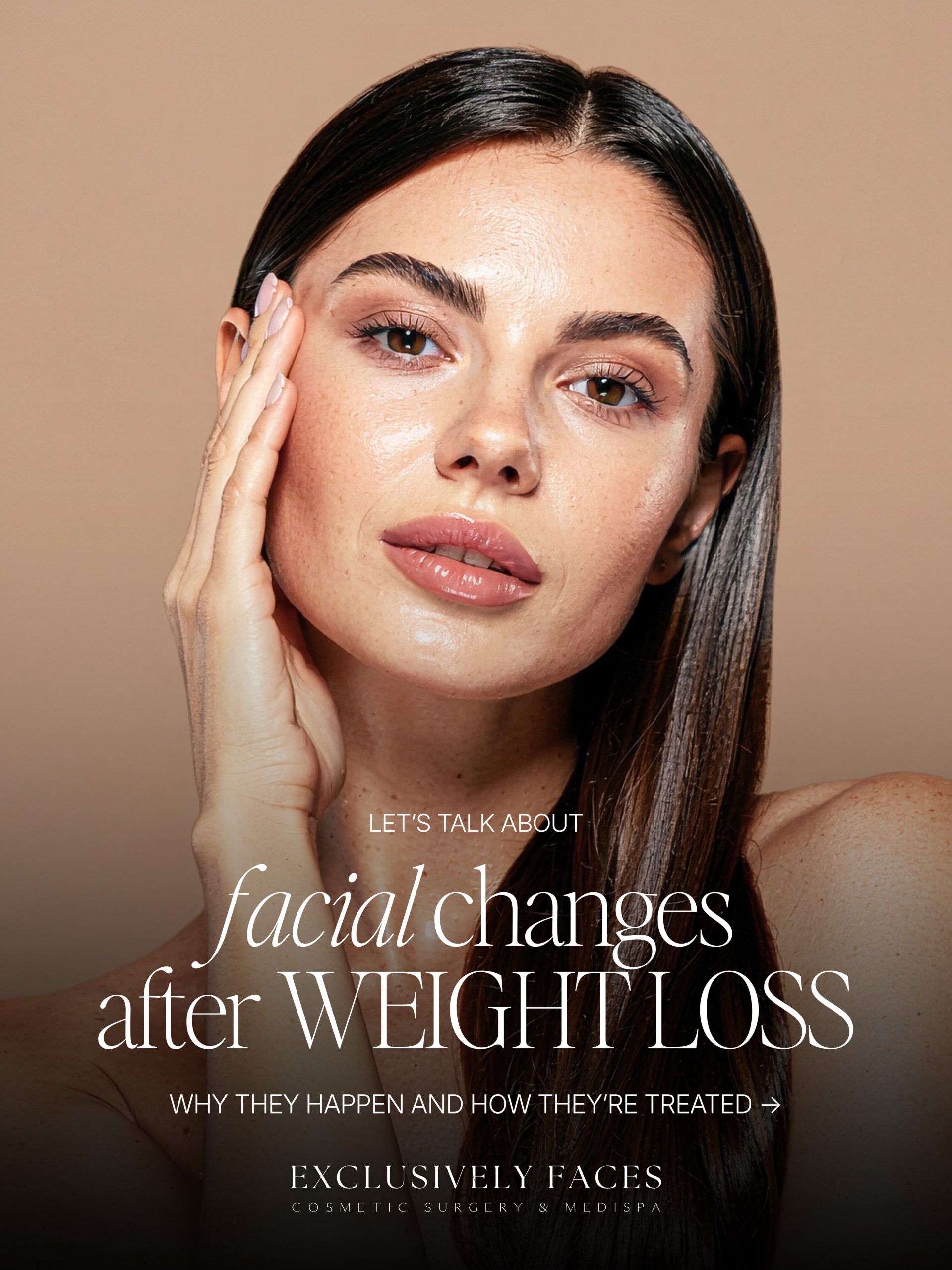 Weight loss can transform your body—but it can also change your face. Volume loss, hollowing, sagging, and loss of definition can create what’s commonly called an “Ozempic face,” although these changes can occur after any significant weight loss. The solution isn’t one-size-fits-all. Sculptra, filler, non-invasive skin tightening or cosmetic surgery may each play a role depending on what has changed. Dr. Matthew Karen, Board-Certified Facial Plastic Surgeon, evaluates the full picture—including facial structure, volume, skin quality, and laxity—to determine which approach will create the most balanced, natural-looking result. Your weight-loss transformation deserves a facial transformation to match Schedule your consultation with Dr. Karen today! 678-857-3211 www.exclusivelyfaces.com Sharpsburg, GA . . #FacialRejuvenation #Facelift #FacialPlasticSurgery #OzempicFace #XERF